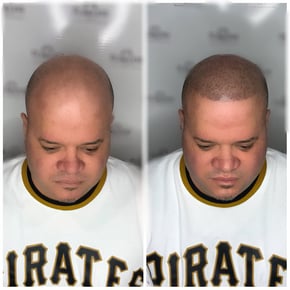 459751A6-2FCC-4CA3-89B6-1996642F981D_Facetune_20-03-2022-20-52-48 (1)